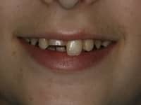 Konig Center for Cosmetic & Comprehensive Dentistry smile photos
